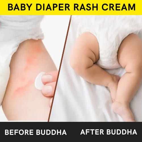 buddha natural baby diaper rash cream before and after image