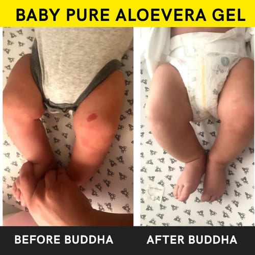 buddha natural baby pure alovera gel before after image