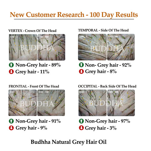 Buddha Natural Grey Hair oil 1 to 100 day result image