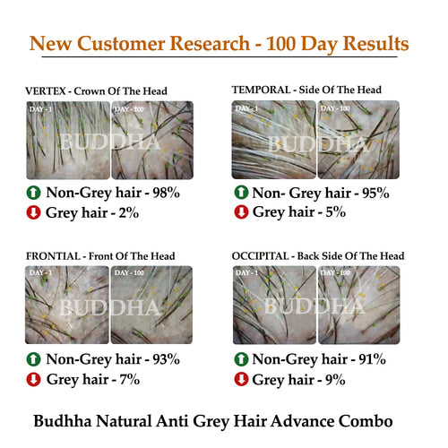 buddha natural grey hair advance combo 10 to 100 day results image