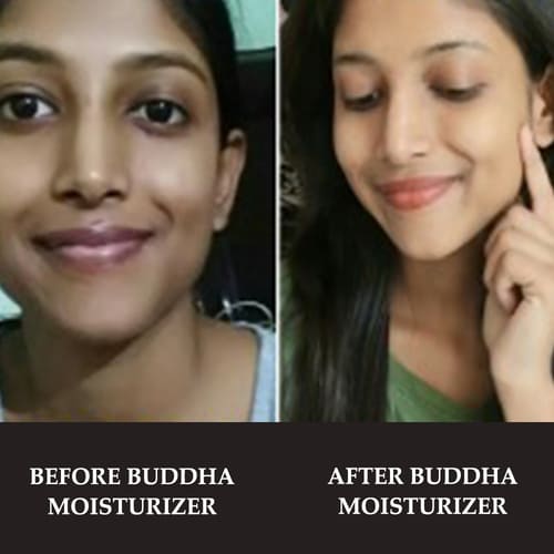 Buddha Natural Moisturizer for Teenager before after image