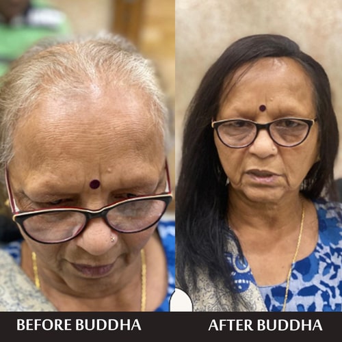 before and after use of adivasi hair growth oil