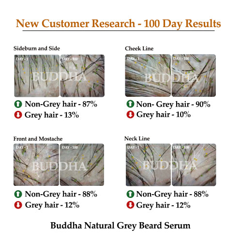 Buddha natural grey beard serum 100 day result image