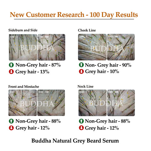 buddha natural anti grey beard serum 1 to 100 days result image