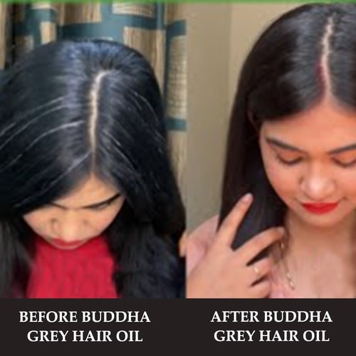 before and after use of Grey Hair Oil For Teenagers (11-19 Years Old)